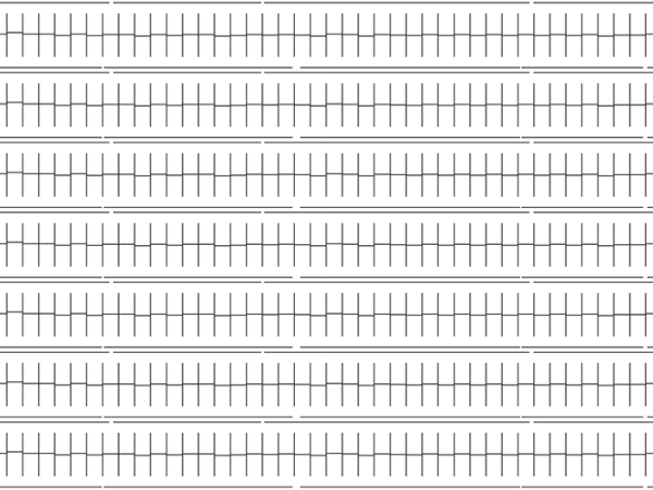 TUILES PICON + FAÎTIÈRE Kit Tuiles Picon + faîtière : 44 bandes de 225 x 6,7 mm Soit 60 cm2 bruts + 2 faîtières de 303 x 6 mm